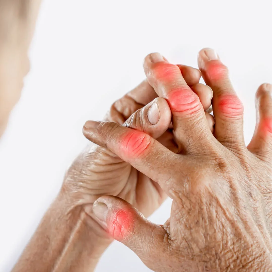 Ayurvedic doctor examining knee joint range of motion at Vedara Care JVC clinic Dubai