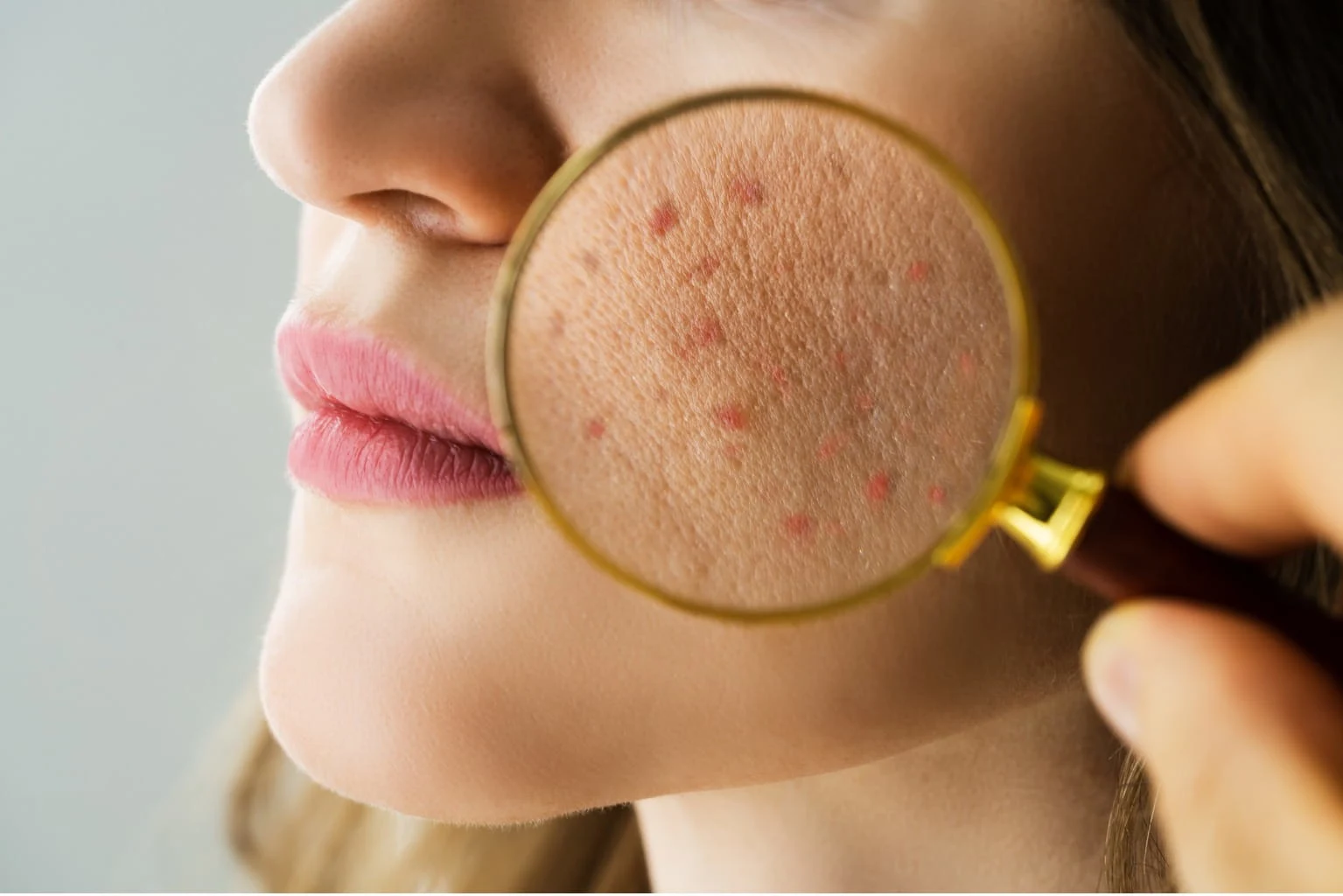 Dermatology treatment room used for Carbon Laser Peel at Vedara Care