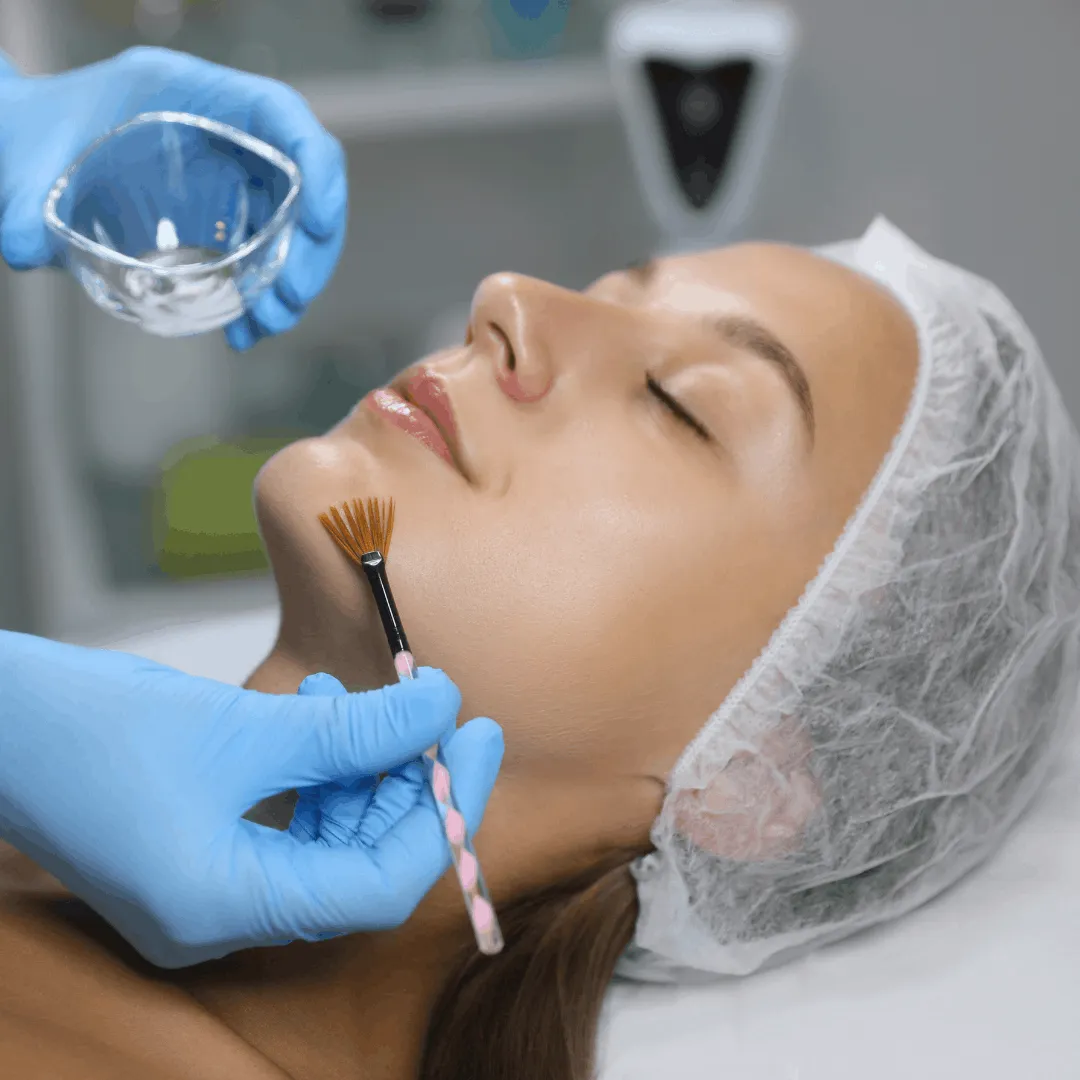 Chemical peel treatment consultation at Vedara Care JVC with consultant dermatologist