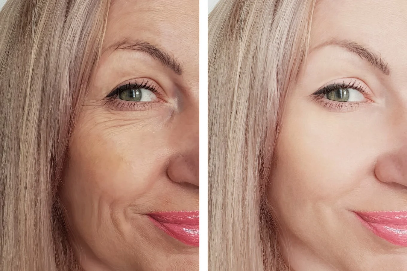 How to prepare for your first Hydrafacial — what to do before and after