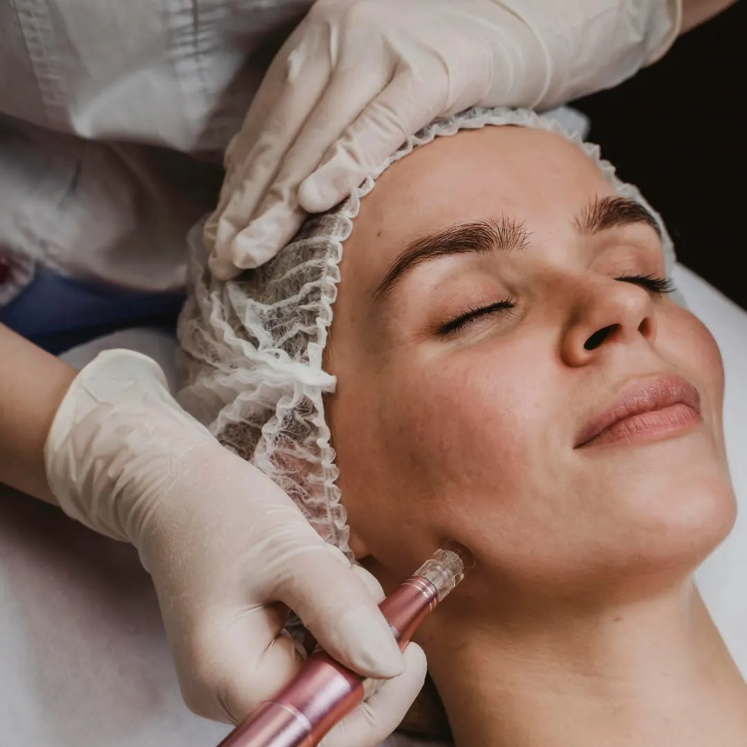 Melasma treatment consultation at Vedara Care JVC Dubai with consultant dermatologist