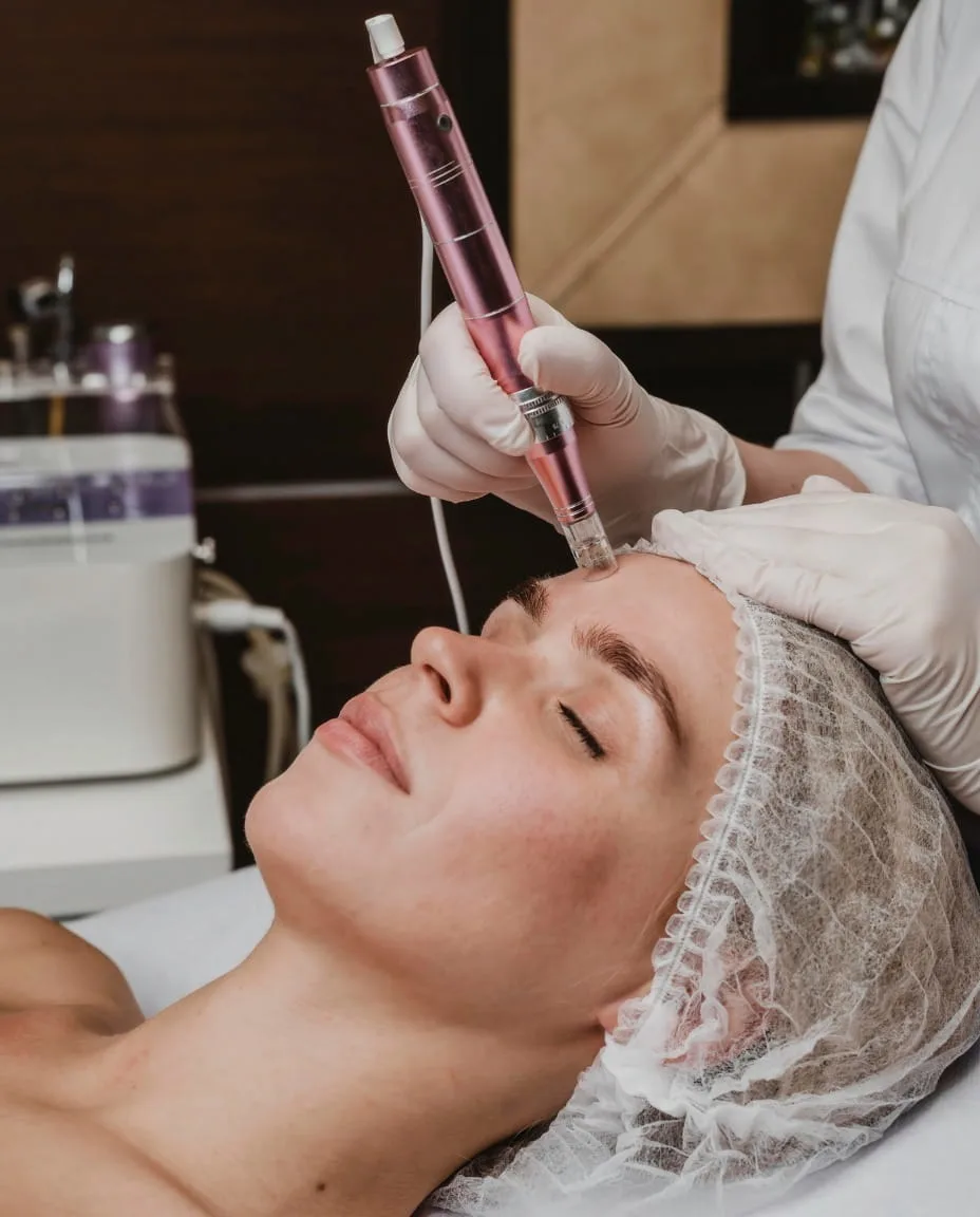 Patient consultation before microneedling treatment at Vedara Care in JVC
