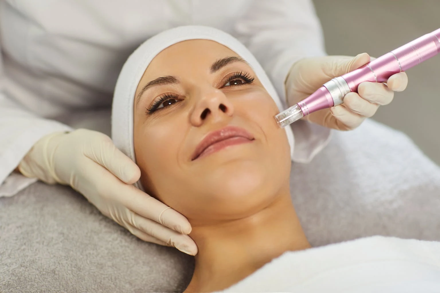 Close-up of a professional microneedling device during treatment