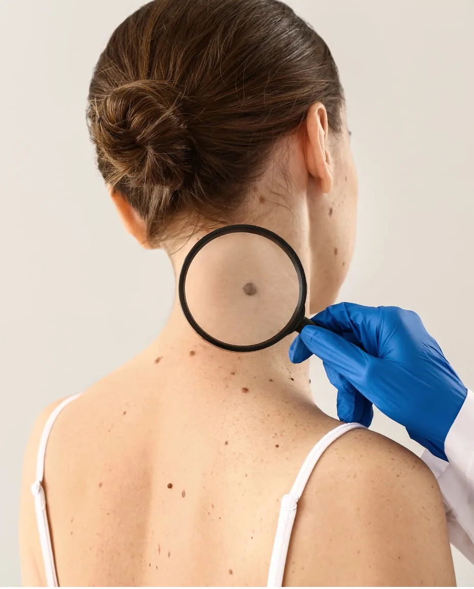 Mole removal procedure room at Vedara Care JVC