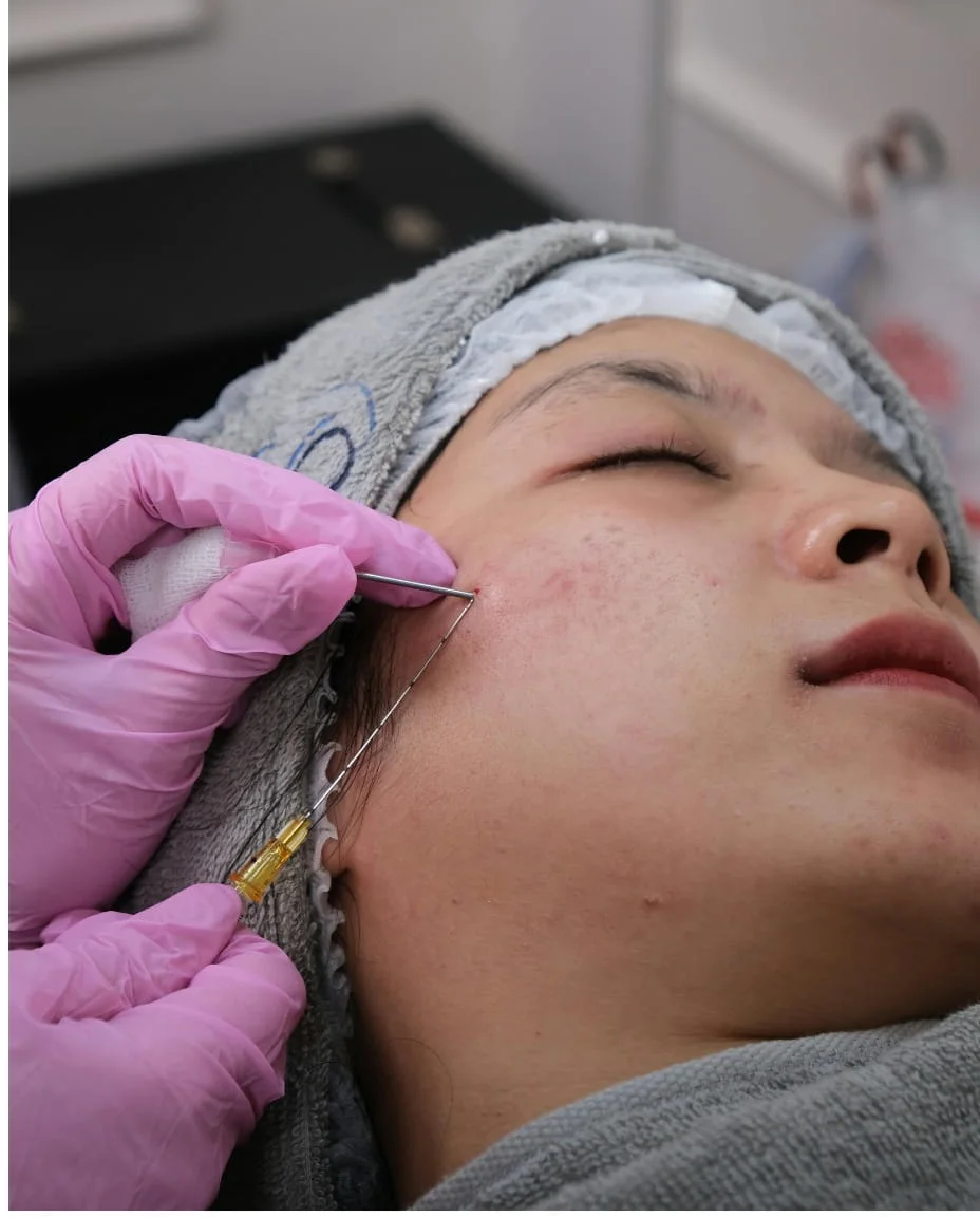 Skin assessment being carried out before microneedling treatment