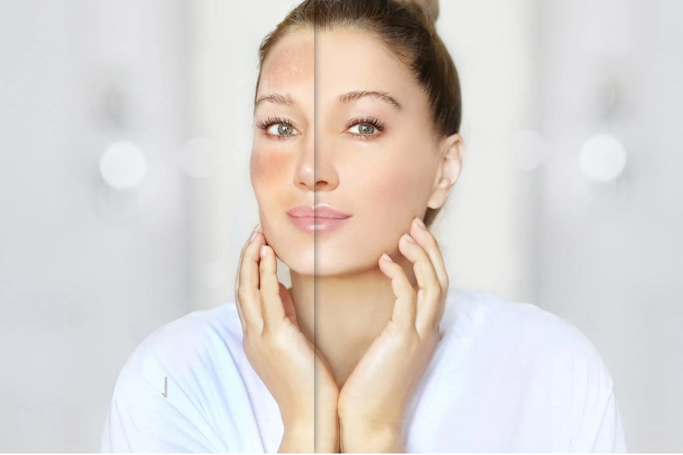 Comprehensive Skin Analysis JVC